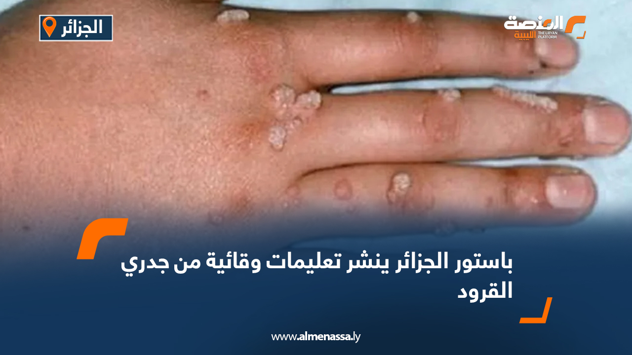 باستور الجزائر ينشر تعليمات وقائية من جدري القرود