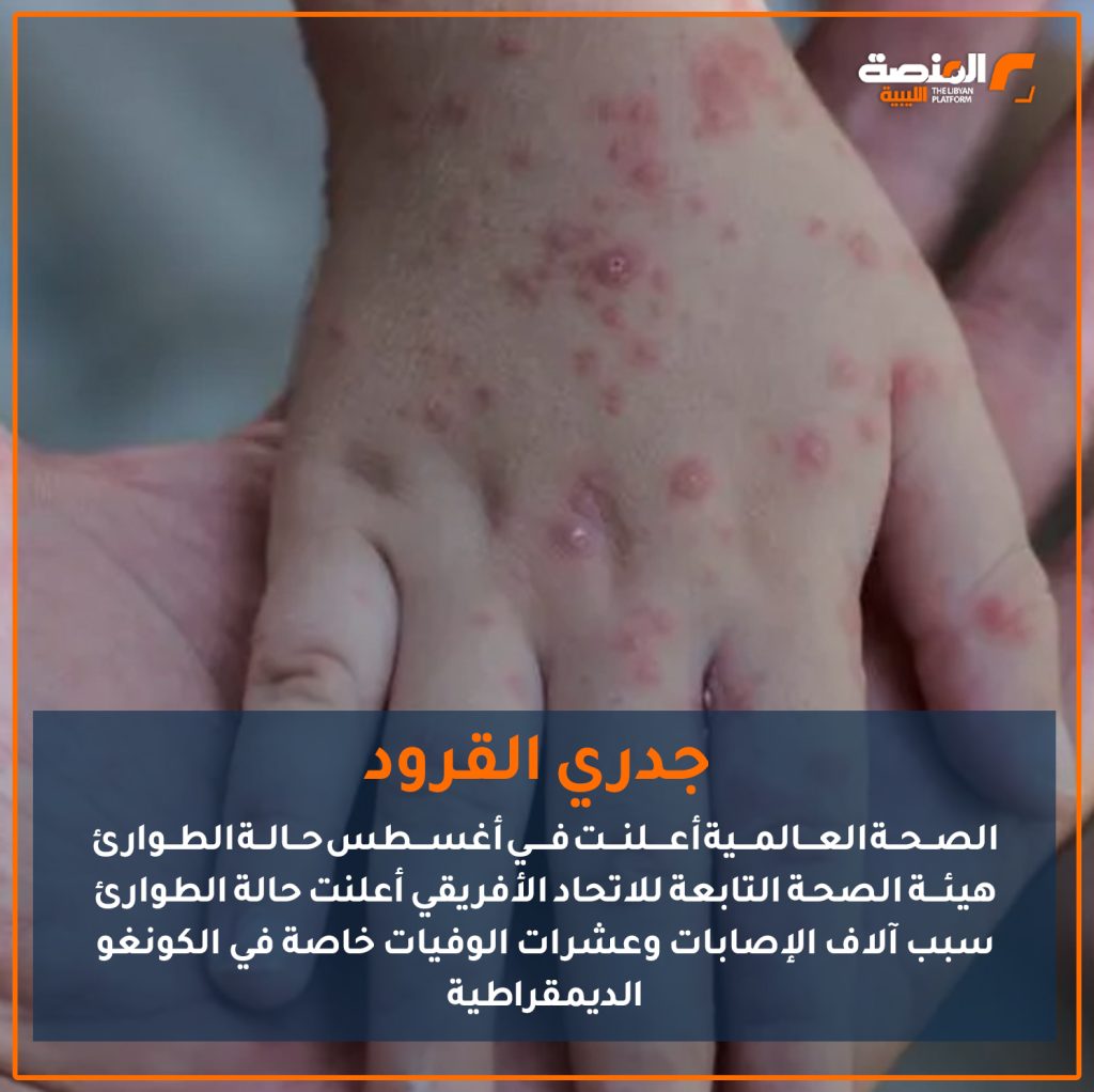 02 copy 9 أبرز الأمراض المعدية التي أرقت العالم في 2024