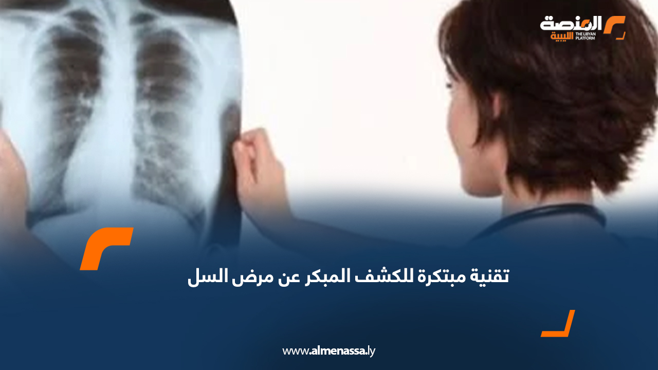 تقنية مبتكرة للكشف المبكر عن مرض السل