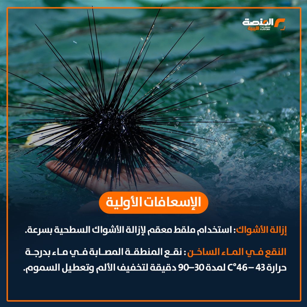 05 copy 22 جمعية علم الأحياء البحرية تحذر من خطورة قنفذ البحر المسجل وجوده في ليبيا لأول مرة في 2021