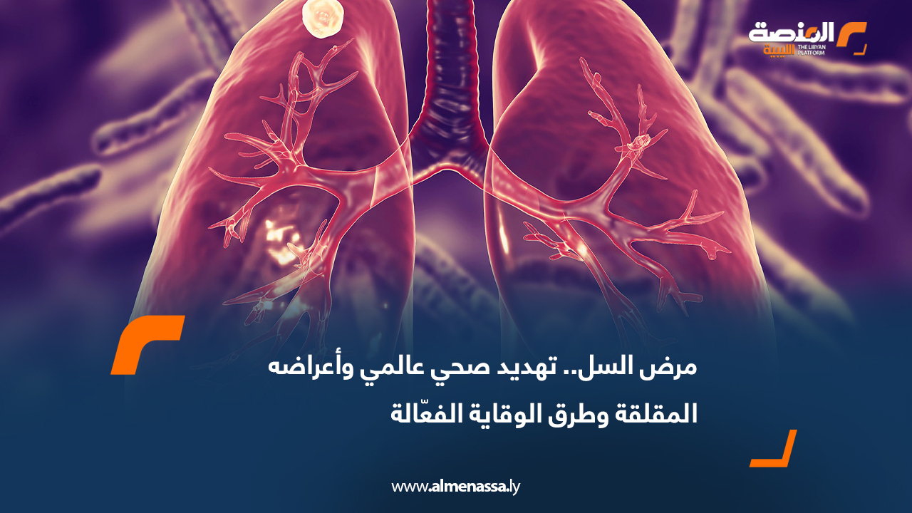 مرض السل.. تهديد صحي عالمي وأعراضه المقلقة وطرق الوقاية الفعّالة