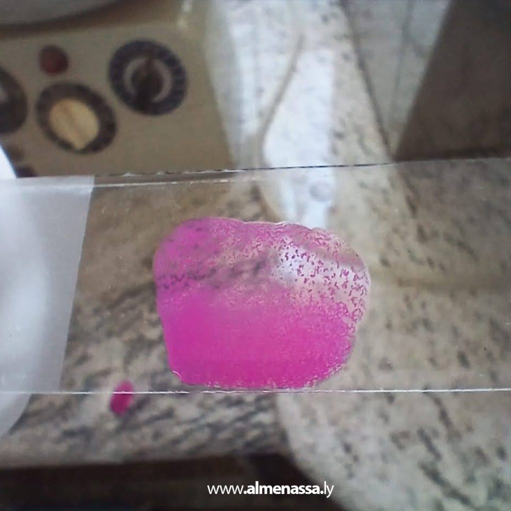 Extra 348 مكتب الصحة الحيوانية بالبيضاء يتخذ إجراءات احترازية لمكافحة أمراض معدية في منطقة مسّة