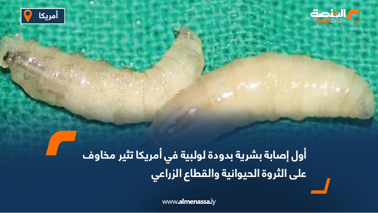 أول إصابة بشرية بدودة لولبية في أمريكا تثير مخاوف على الثروة الحيوانية والقطاع الزراعي