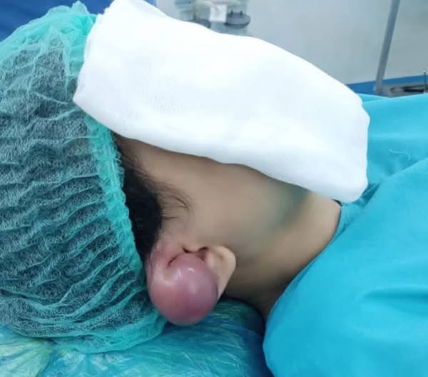 548379192 1260496812756915 962295299289890091 n أطباء مصريون يحذرون من خطر الثقب الإضافي للأذن المعروف بالبيرسينج