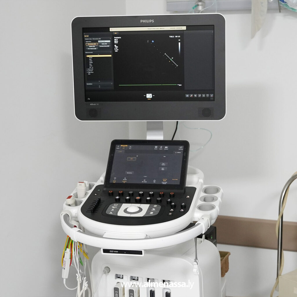 Extra 9.jpg11 9 خطوة جديدة نحو تحسين تشخيص أمراض القلب في بنغازي عبر تعاون الإمداد الطبي وPHILIPS