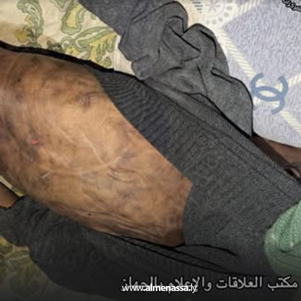 Extra 13.jpg11 13 وفاة طفل يتيم بعد تعرضه للتجويع والاعتداء وضبط المتورطين وإحالتهم للجهات المختصة