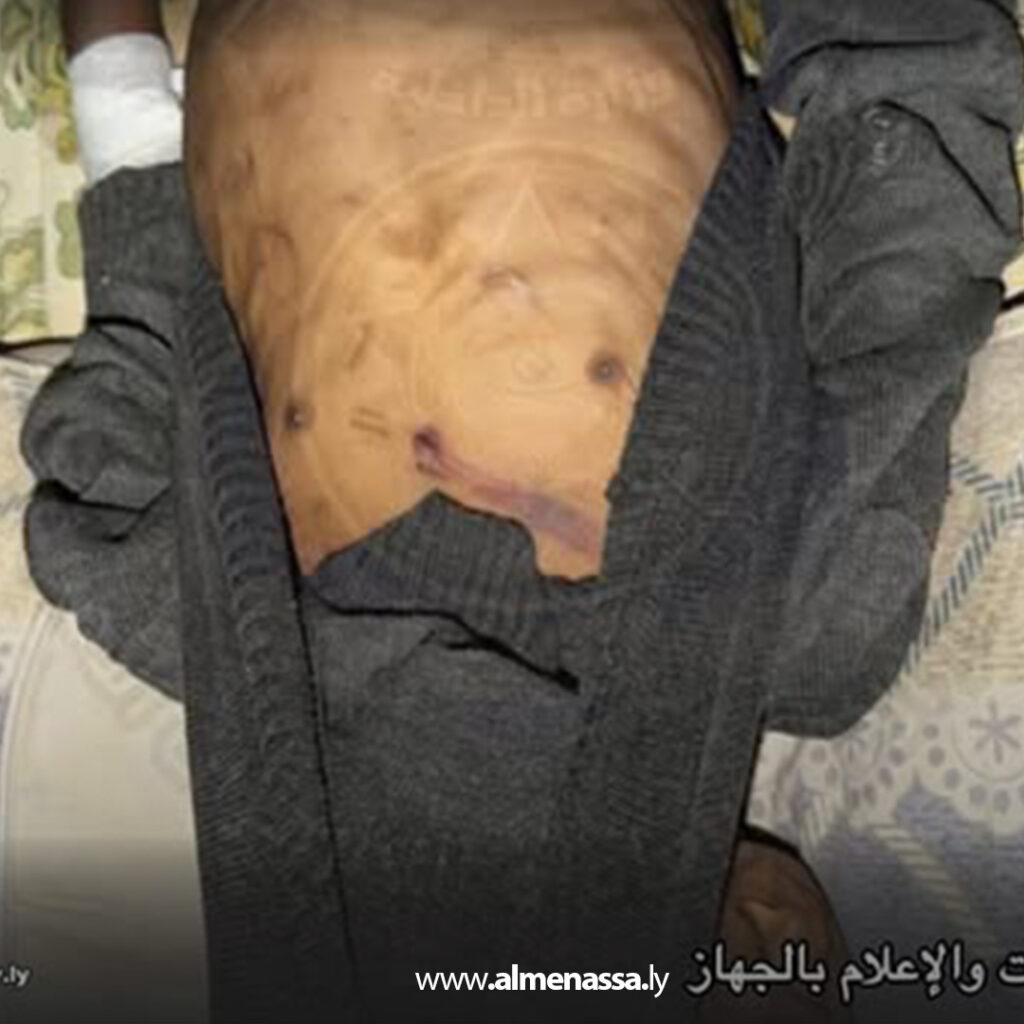 Extra 8.jpg111 8 وفاة طفل يتيم بعد تعرضه للتجويع والاعتداء وضبط المتورطين وإحالتهم للجهات المختصة