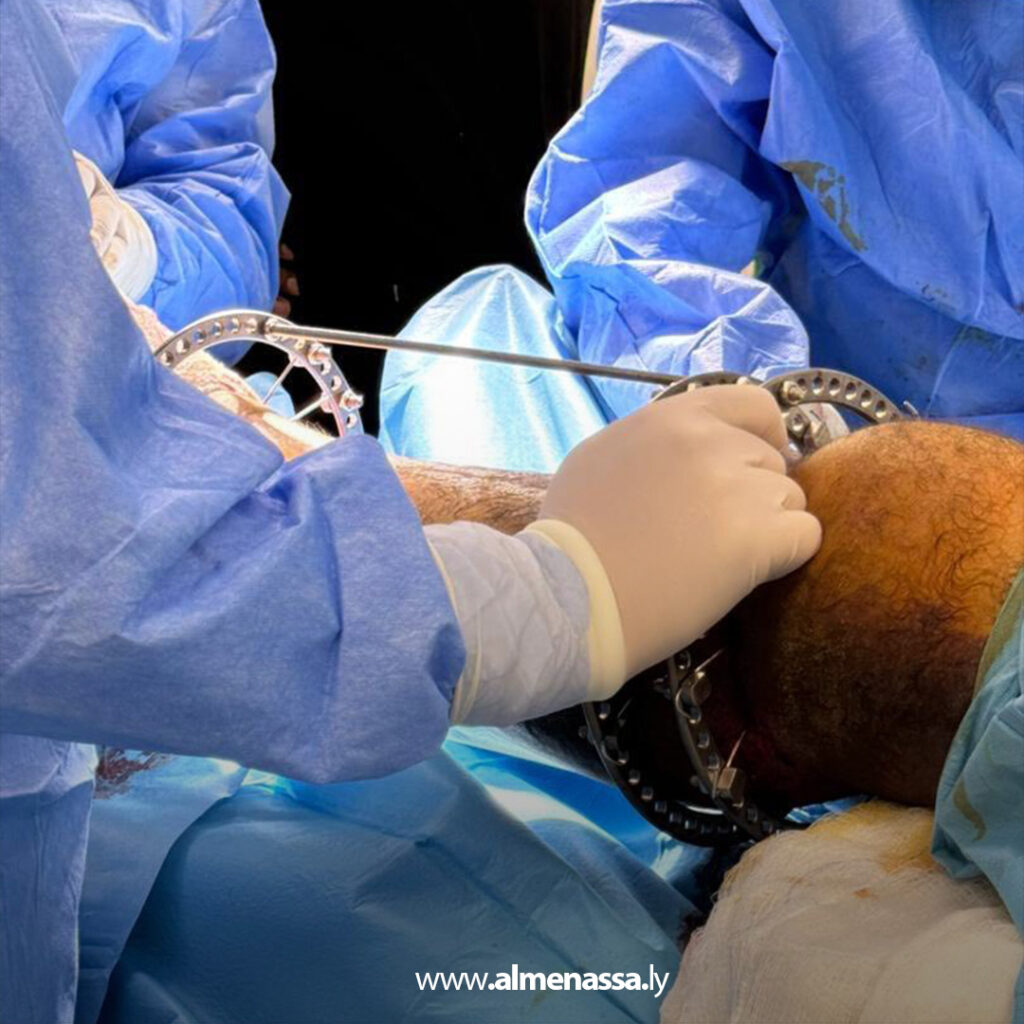 نجاح عملية تثبيت كسر معقّد بتقنية الليزاروف بمستشفى الخضراء 2 Extra 144.jpg1 144