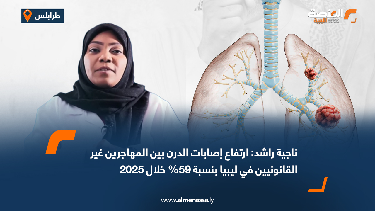 ارتفاع إصابات الدرن بين المهاجرين غير القانونيين في ليبيا بنسبة 59% خلال 2025