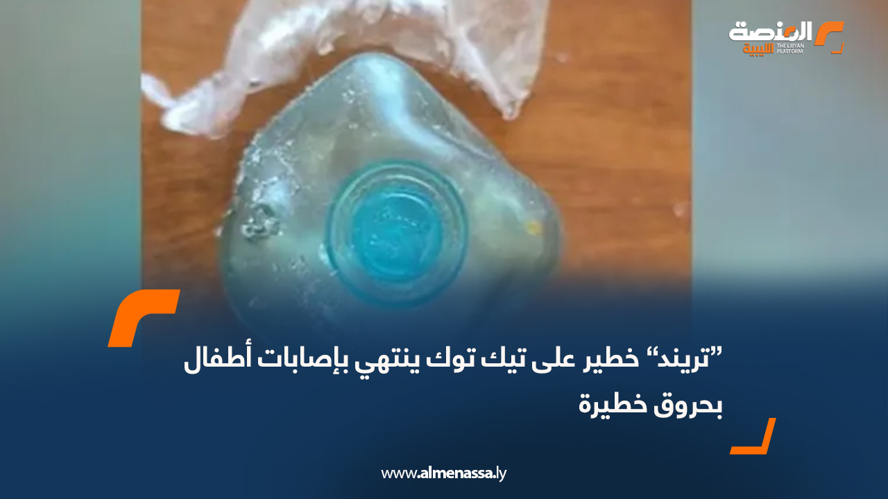 “تريند” خطير على تيك توك ينتهي بإصابات أطفال بحروق خطيرة