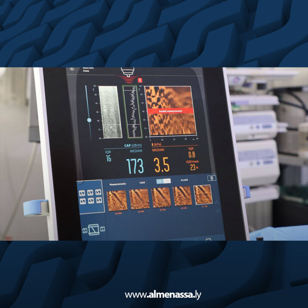 extra Recovered Recovered