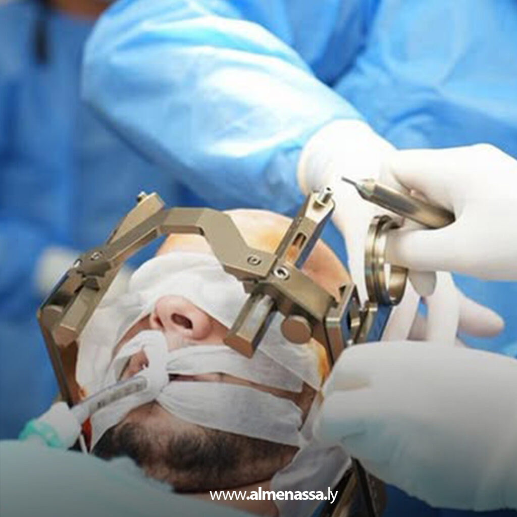 Extra 56.jpg11 56 للمرة الأولى في القطاع العام: مستشفى الخضراء يجري عمليات علاج الشلل الرعاشي بتقنيات متقدمة