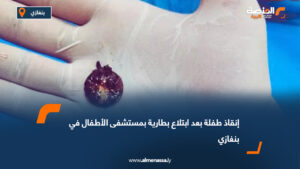 إنقاذ طفلة بعد ابتلاع بطارية بمستشفى الأطفال في بنغازي