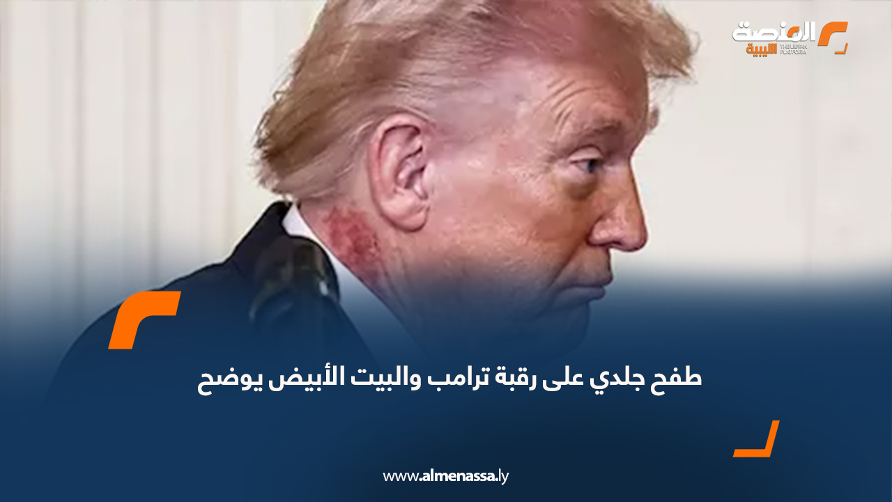 طفح جلدي على رقبة ترامب والبيت الأبيض يوضح