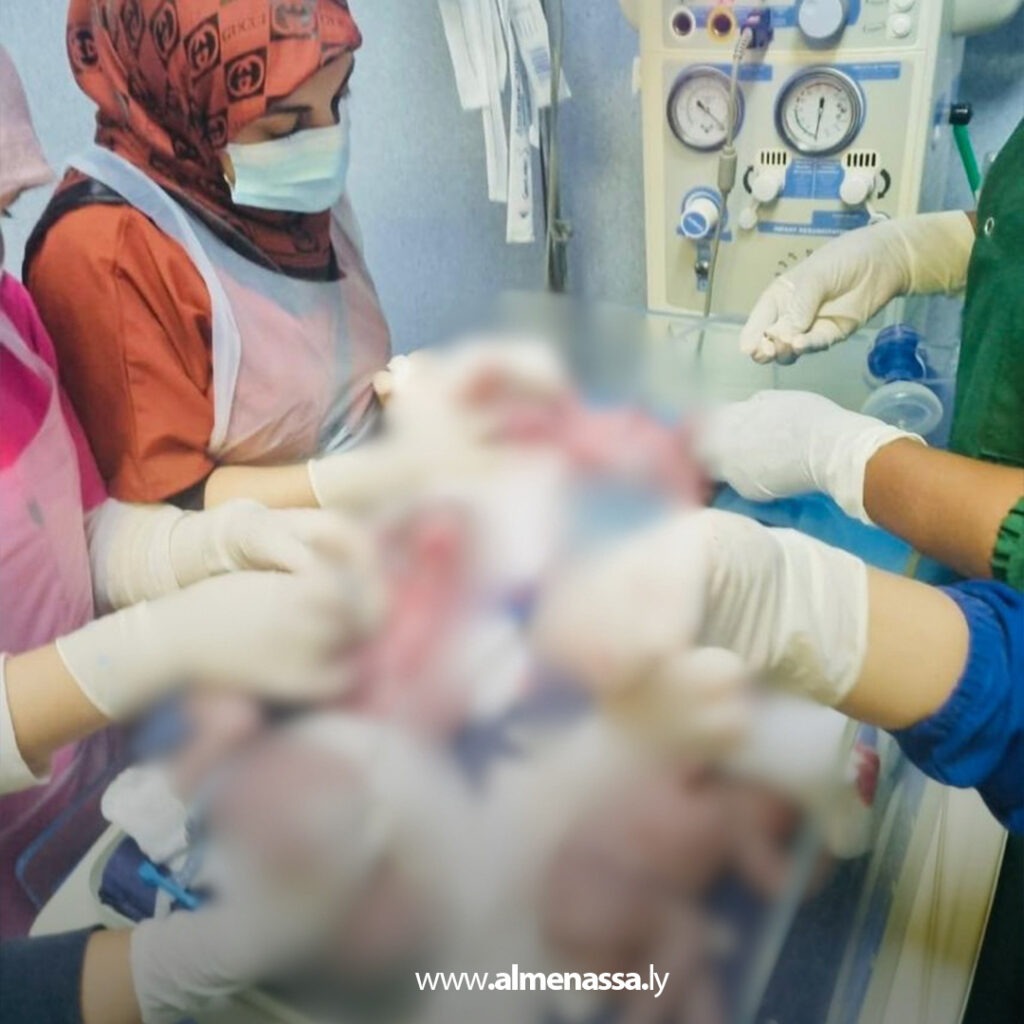 Extra 176 ولادة 4 توائم في الشهر الثامن بمستشفى الجلاء للولادة بحالة نادرة واستثنائية