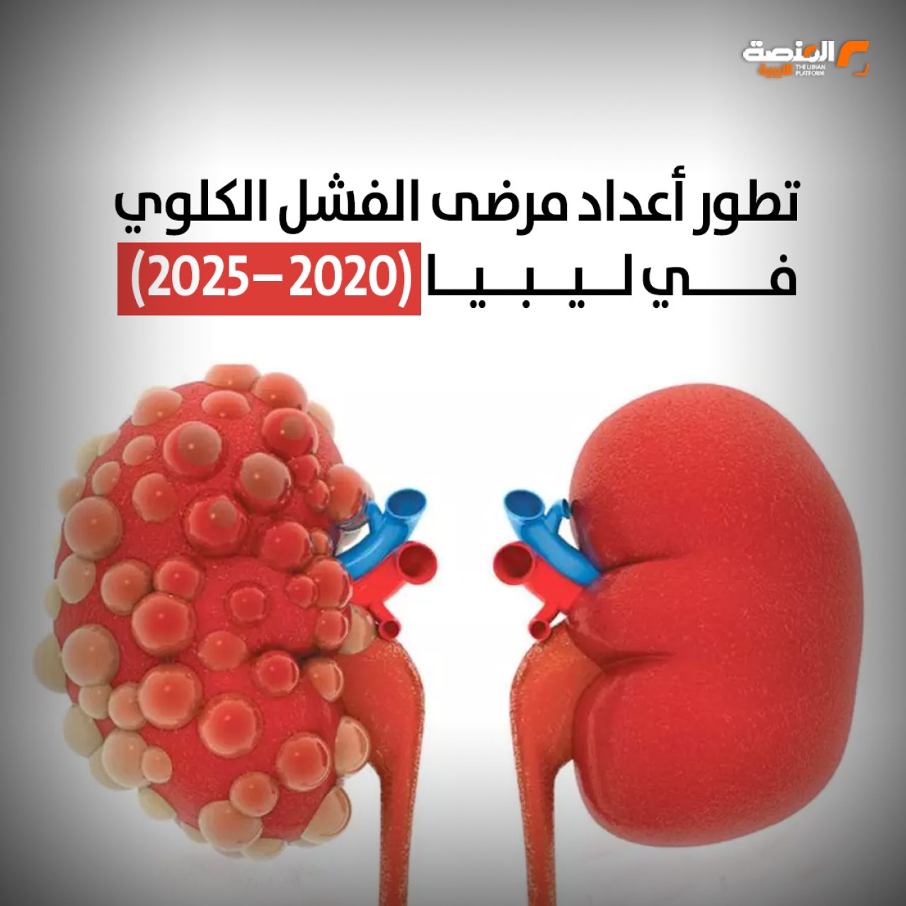 تطور أعداد مرضى الفشل الكلوي في ليبيا ما بين 2020-2025