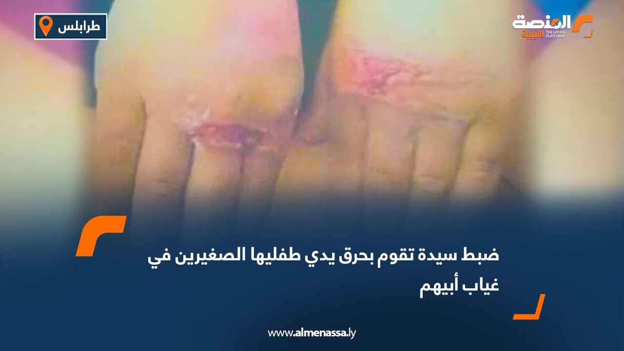 ضبط سيدة تقوم بحرق يدي طفليها الصغيرين في غياب أبيهم