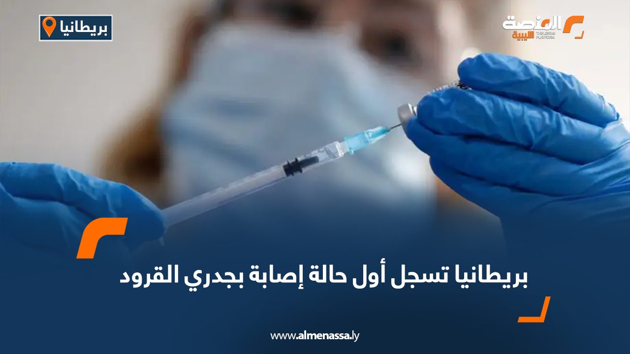 بريطانيا تسجل أول حالة إصابة بجدري القرود