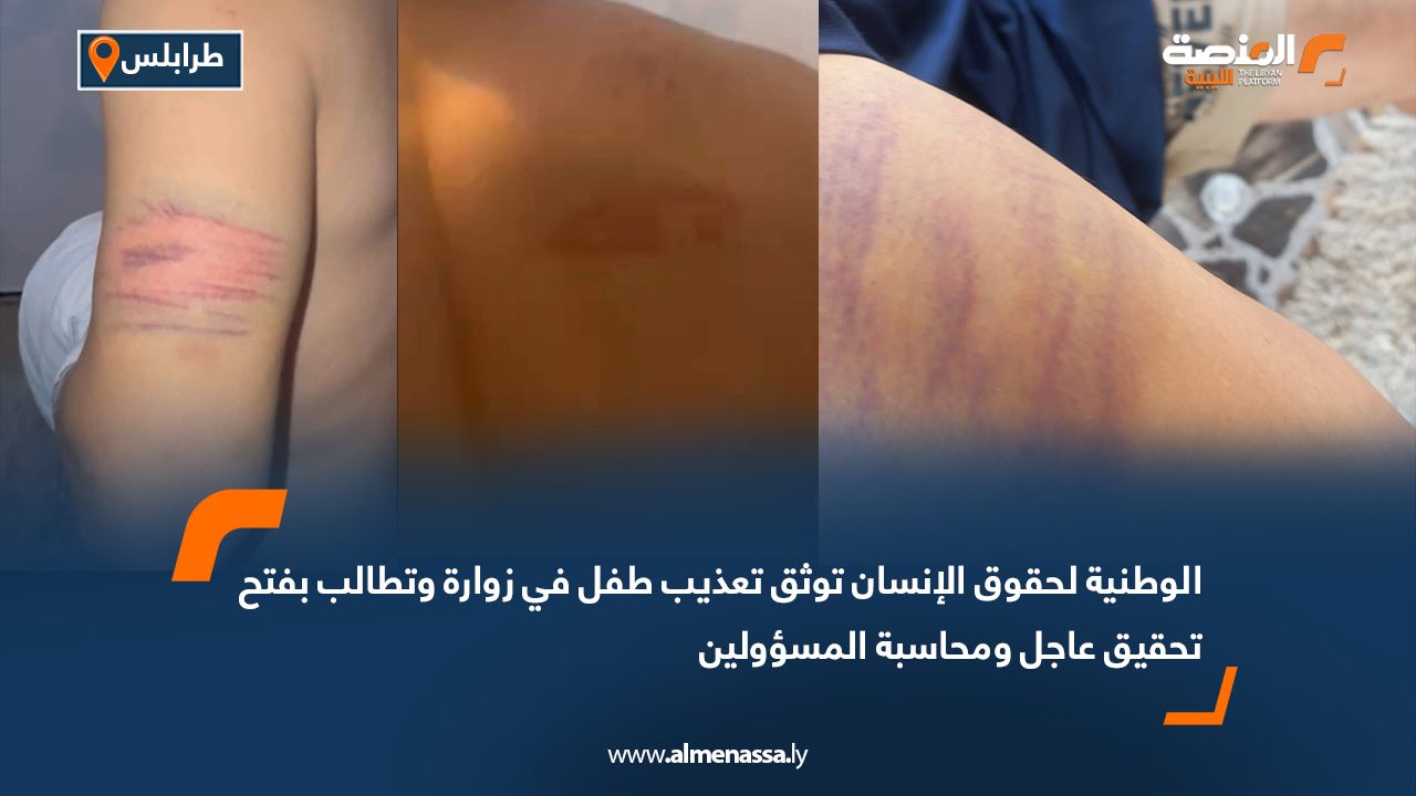 الوطنية لحقوق الإنسان توثق تعذيب طفل في زوارة وتطالب بفتح تحقيق عاجل ومحاسبة المسؤولين