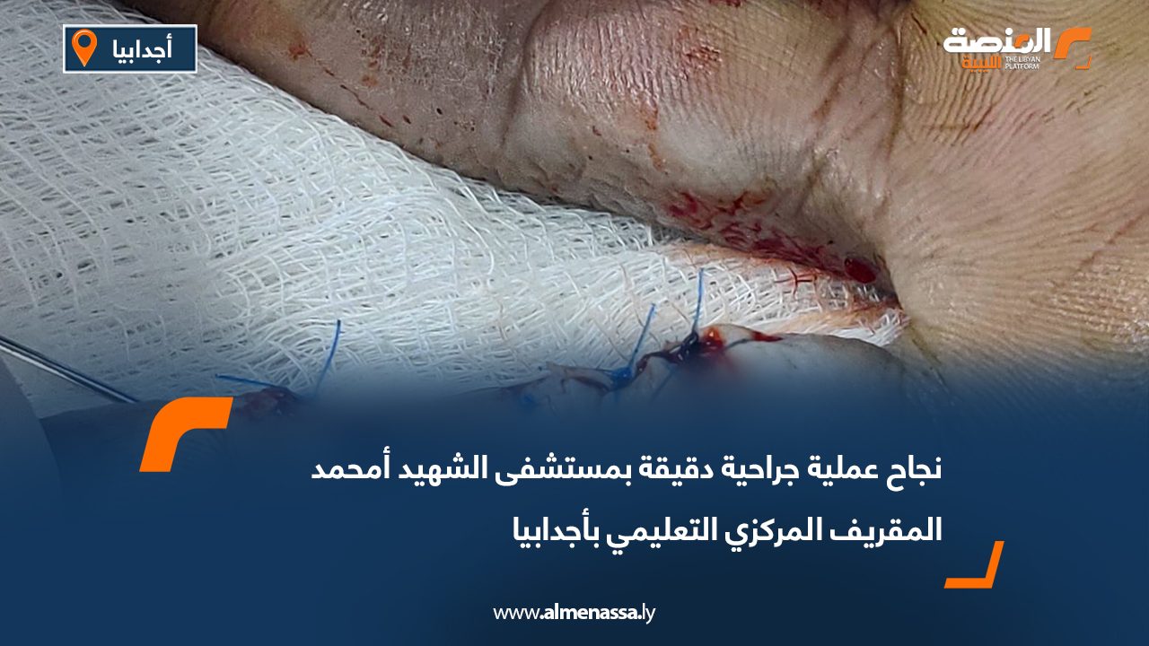 نجاح عملية جراحية دقيقة بمستشفى الشهيد أمحمد المقريف المركزي التعليمي بأجدابيا