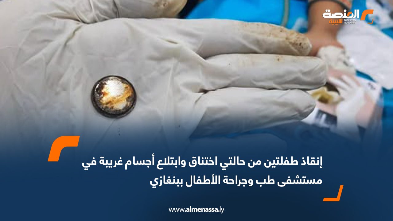 إنقاذ طفلتين من حالتي اختناق وابتلاع أجسام غريبة في مستشفى طب وجراحة الأطفال ببنغازي